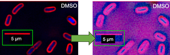 2 images of cells. The left image is the submitted manuscript version. The second image is created with image forensic tools showing a box-shaped artifact behind the scale bar.